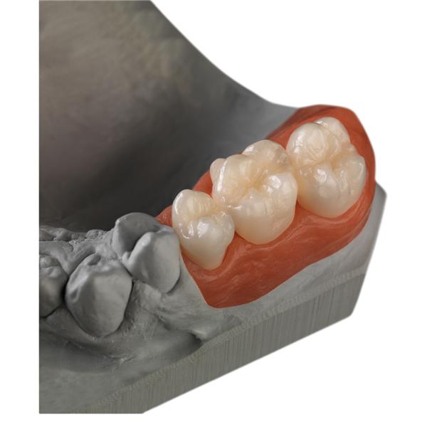 Ceramill Zolid FX Zirconia Disc Multi Layer A1 98x20 Ea