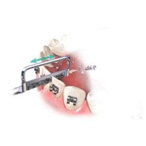 Intensiv Ortho-Strip assort 4/Paquet