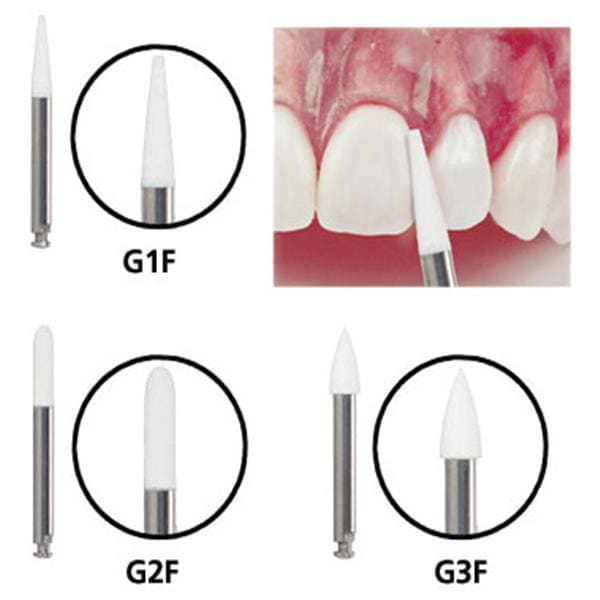 Galaxy Debonding Polisher 3/Pk