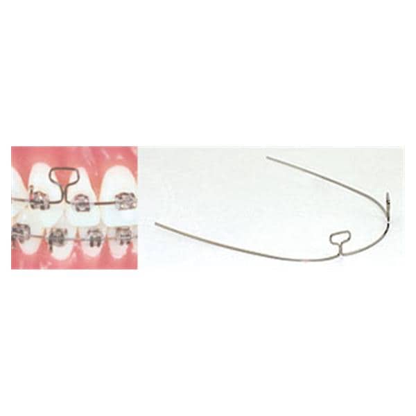 Retraction Archwire 0.016 in x 0.022 in 10/Pk