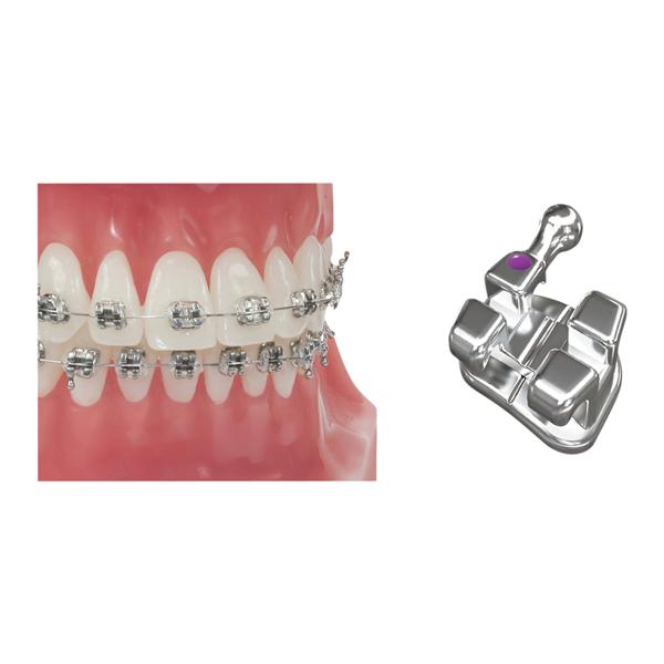MBT Bracket 0.022 in UL2 10/Pk