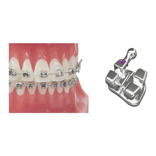 Roth Bracket 0.022 in UL3 10/Pk