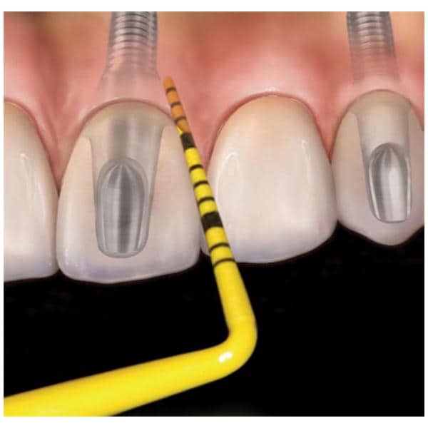 Colorvue Periodontal Probe Promo Kit Single End #6 Yellow Kit