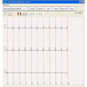 USB ECG New Ea