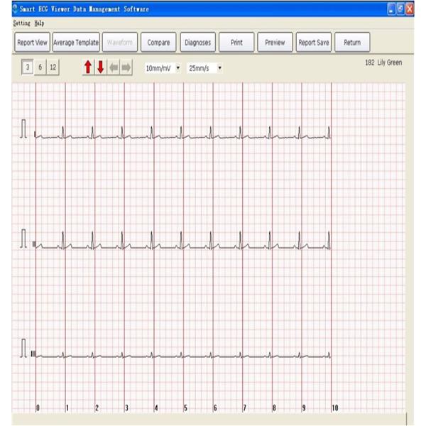 USB ECG New Ea