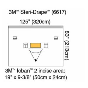 Steri-Drape Ioban 125x83" Sterile Surgical Drape, 4 BX/CA