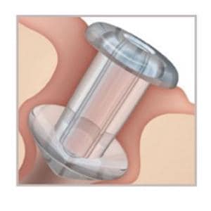 Soft Plug Punctum Ophthalmic Plug 0.4mm Micro