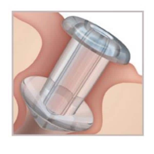 Soft Plug Punctum Ophthalmic Plug 0.4mm Micro