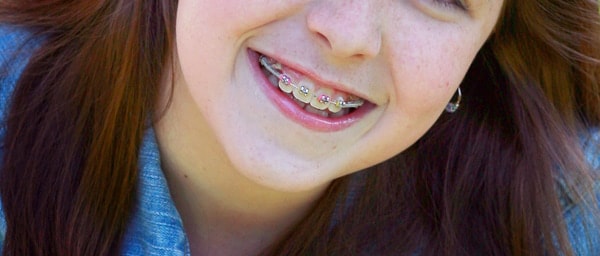 Orthodontie